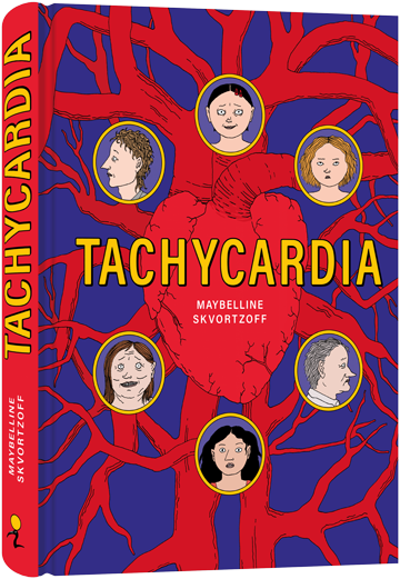 Tachycardia